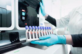 Akupunktur in der Praxis für Traditionelle Chinesische Medizin.